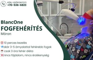Fogfehérítés Móron, a Dr. Böjte Fogorvosi Rendelőben